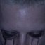 tear