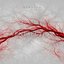 Venesection