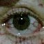 BLOODSHOT