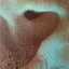 Meddle