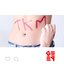 TKM