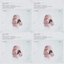 QUARTETS
