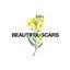 Beautiful Scars (Maximillian x Moira Dela Torre) [Acoustic]