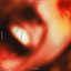 RAINING BLOOD (feat. ZillaKami)