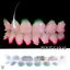 Root Canal