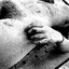 The Fixation