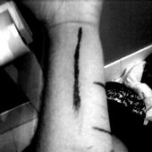 A. Morbid