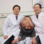 elephantman.jpg