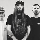 Vulvodynia