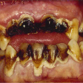 MOUTHFUR için avatar