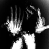 x-ray