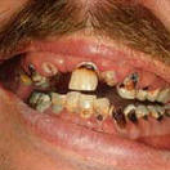 Avatar de methmouth