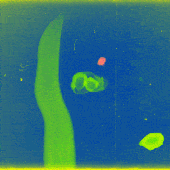 Avatar for solvettcoagula