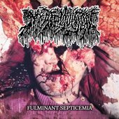 Fulminant Septicemia