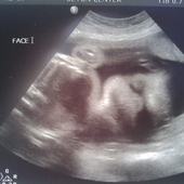 Avatar for NymphetamineLu