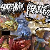 Mincegore Appendix Removal - EP