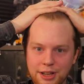 nitro radical hairline