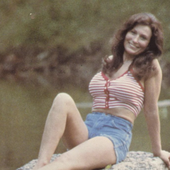 Loretta-Lynn-Plastic-Surgery-Body-768x527.png