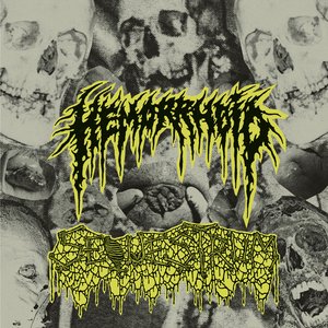 Image for 'Hemorrhoid / Sequestrum- Split'