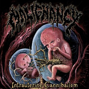 Image for 'Intrauterine Cannibalism (1999)'