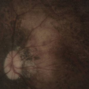Изображение для 'Bereft of Xerotic Layers (Album)'