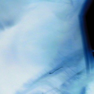 Image for 'Symmetrical Syndrome'