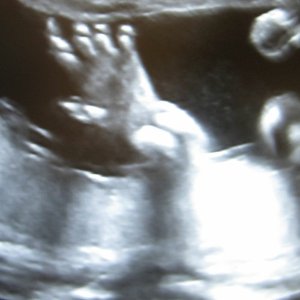 Image for 'life'