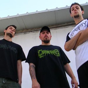Zdjęcia dla 'Vulvectomy'