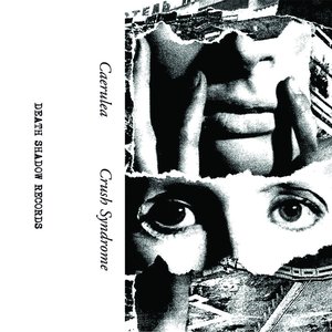 'Crush Syndrome'の画像