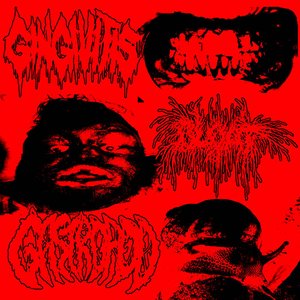 Image for 'Gingivitis / Bloat / Gastropod'
