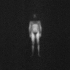 Image for 'IRA'