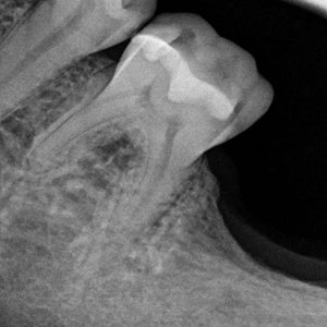 'Dental Work'の画像