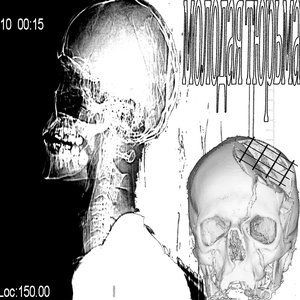 Image for 'Молодая тюрьма'