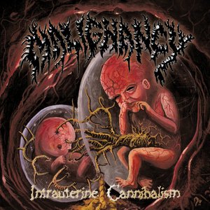 Image for 'Intrauterine Cannibalism'