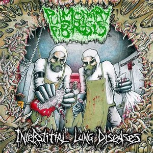 Image for 'Interstitial Lung Diseases'