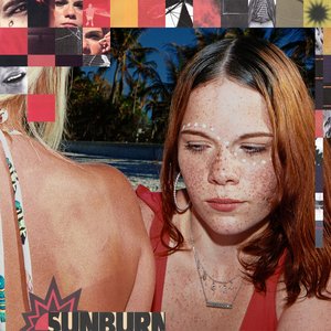 Image pour 'Sunburn'