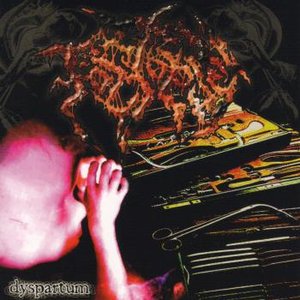 Image for 'Dyspartum'