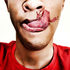 Avatar for Mesotheliomatic