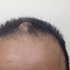 Avatar di ArtificialCyst