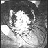 Avatar for Brainbombs