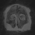 Avatar for GilHinUnge