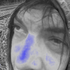 Avatar for FlyingOintment